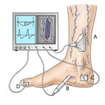 Krampfadern werden mit der Farbultraschall Untersuchung (A) mit Bild- und Flussdarstellung oder mit der Dopplersonde (B) nur mit Flussdarstellung abgeklärt. Der gesamte Venenabstrom wird mit der Lichtreflexionsrheographie (LRR) (C) gemessen. Die arterielle Durchblutung mit der digitalen Oszillographie (D).